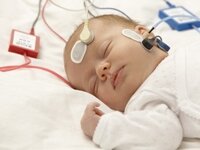 Аудиологический скрининг новорожденных: суть процедуры и методика выполнения